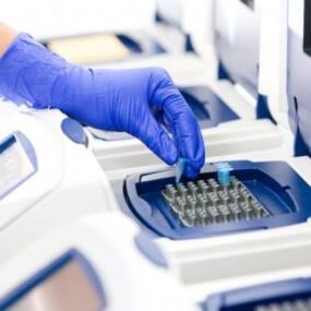 PCR analizi