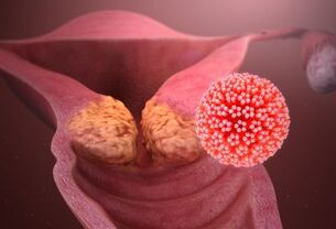 HPV'ye hangi hastalıklar neden olur